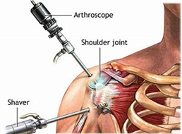 Endoscopic-surgery