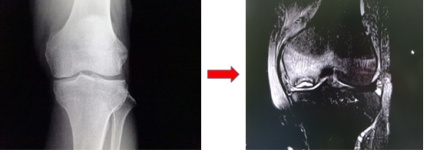 MRI MRI