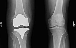 reconstruction surgery reconstruction-surgery